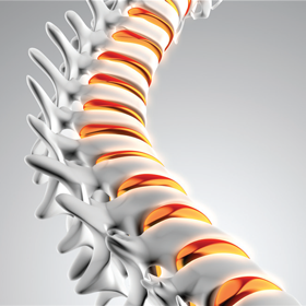 Neurosurgical Spine Program